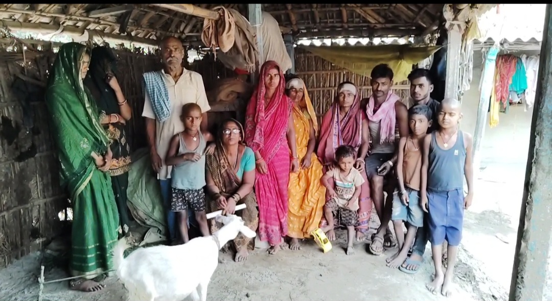 बकरी के हुए विवाद में जमकर हुई मारपीट मां बेटी जख्मी, डेरहार थाना को आवेदन देकर न्याय का लगाया गुहार